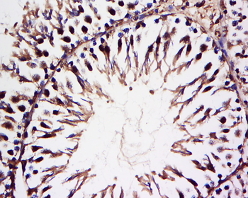 HECT E3 ubiquitin ligase Rabbit Polyclonal Antibody