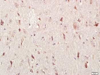 HEG1 Rabbit Polyclonal Antibody