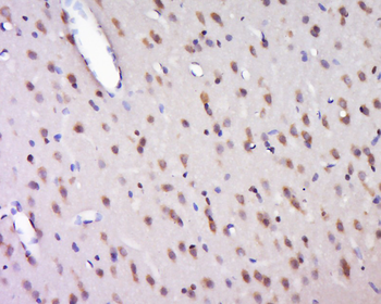 HELZ Rabbit Polyclonal Antibody