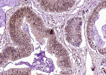 Phospho-HER2 (Tyr1222) Rabbit Polyclonal Antibody