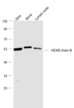 HEXB chain B Rabbit Polyclonal Antibody