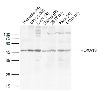 HOXA13 Rabbit Polyclonal Antibody