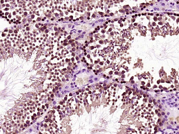 HOXC5 Rabbit Polyclonal Antibody