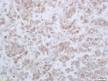 MX1 + MX2 Rabbit Polyclonal Antibody