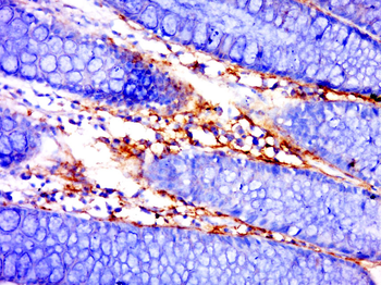 IFNK Rabbit Polyclonal Antibody