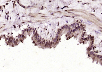 IKAP Rabbit Polyclonal Antibody
