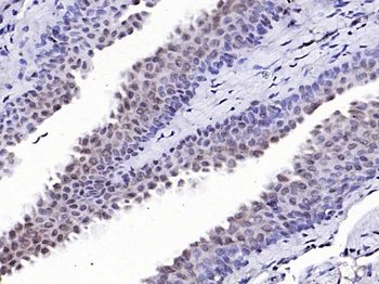 IKK beta Rabbit Polyclonal Antibody