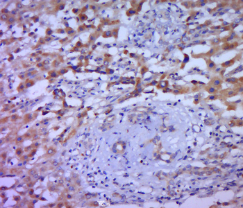 IL-1 Alpha Rabbit Polyclonal Antibody