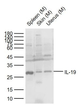IL-19 antibody