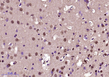 IRX1 Rabbit Polyclonal Antibody