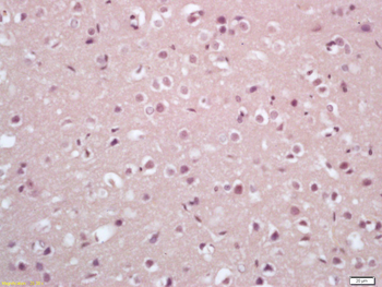 IRX1 Rabbit Polyclonal Antibody