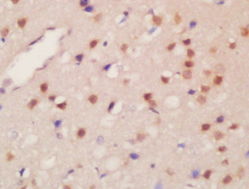 Phospho-KDM4B (Thr305) Rabbit Polyclonal Antibody