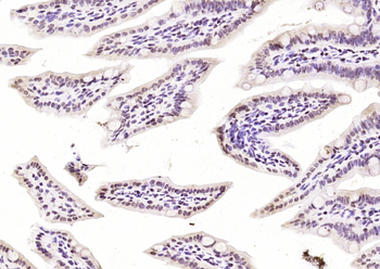 KAT3A / CBP Rabbit Polyclonal Antibody