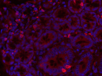 Fibronectin/FN1 Rabbit Polyclonal Antibody (BF647)
