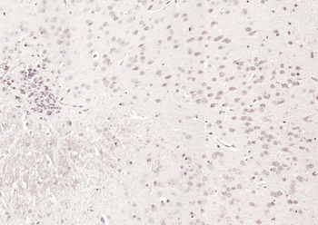 KIBRA Rabbit Polyclonal Antibody