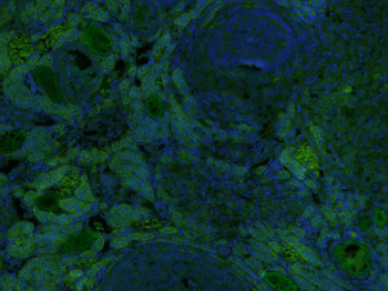 KIF13B Rabbit Polyclonal Antibody