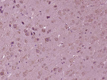 KIF7 Rabbit Polyclonal Antibody