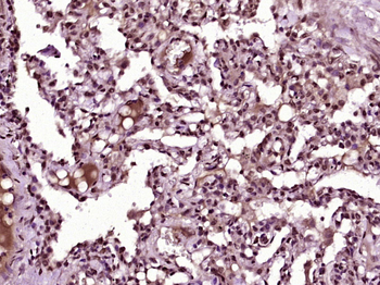Kindlin 2 Rabbit Polyclonal Antibody