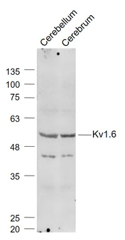 Kv1.6 Rabbit Polyclonal Antibody