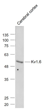Kv1.6 Rabbit Polyclonal Antibody