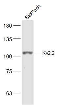 Kv2.2 Rabbit Polyclonal Antibody