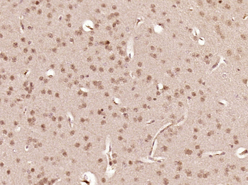 LHX2 Rabbit Polyclonal Antibody