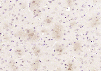 Limd1 Rabbit Polyclonal Antibody