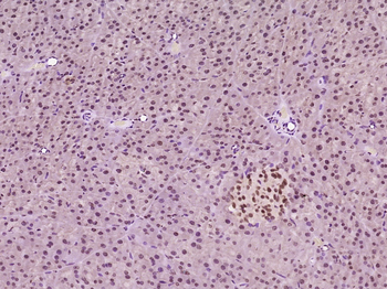 LMX1b Rabbit Polyclonal Antibody