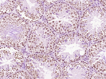 LMX1b Rabbit Polyclonal Antibody