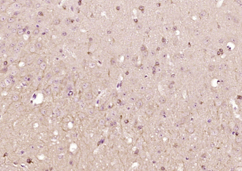 PLPPR1 Rabbit Polyclonal Antibody