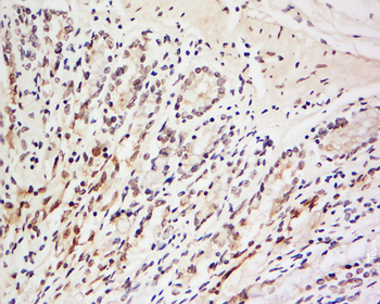 LRRC39 Rabbit Polyclonal Antibody