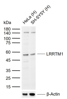 LRRTM1 Rabbit Polyclonal Antibody