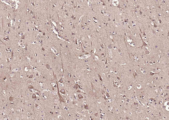 Monoamine Oxidase B Rabbit Polyclonal Antibody