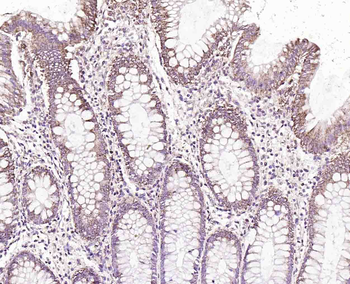 Monoamine Oxidase B Rabbit Polyclonal Antibody
