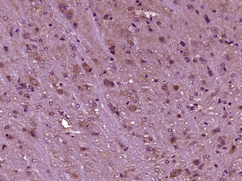 MAP2K1IP1 Rabbit Polyclonal Antibody