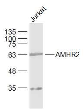 AMHR2 Rabbit Polyclonal Antibody