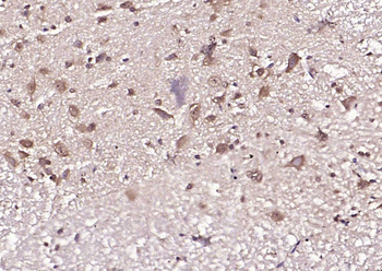 MLC1 Rabbit Polyclonal Antibody