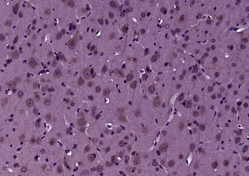 MLC1 Rabbit Polyclonal Antibody