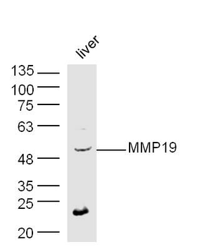 MMP19 Rabbit Polyclonal Antibody