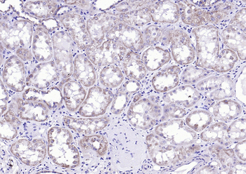 MPP5 Rabbit Polyclonal Antibody