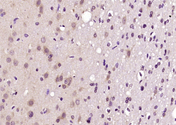 FEZ1 Rabbit Polyclonal Antibody