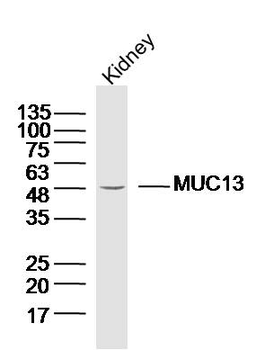 MUC13 Rabbit Polyclonal Antibody