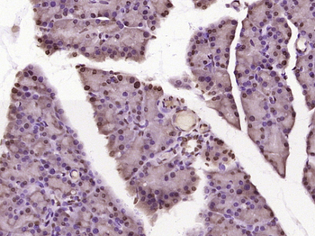 MYO6 Rabbit Polyclonal Antibody