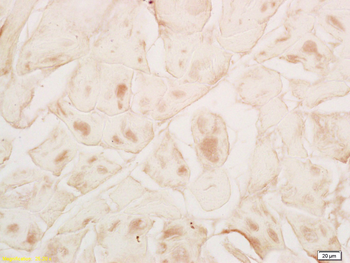 MYPN Rabbit Polyclonal Antibody