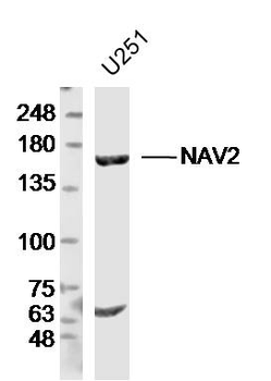 NAV2 Rabbit Polyclonal Antibody