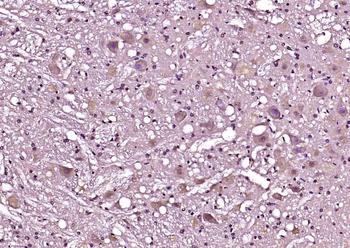 NCS1 Rabbit Polyclonal Antibody