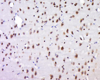 NECAB1 Rabbit Polyclonal Antibody