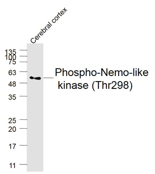 Phospho-NLK (Thr298) Rabbit Polyclonal Antibody