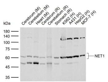 NET1 Rabbit Polyclonal Antibody
