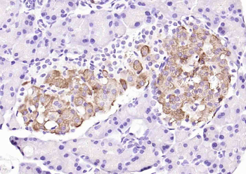 NEURL Rabbit Polyclonal Antibody